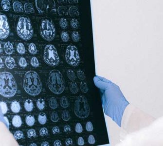 doctor hold brain reel