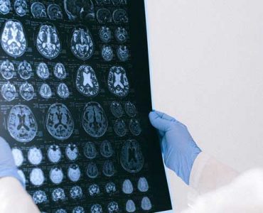 doctor hold brain reel
