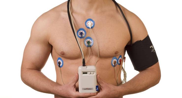 Holter Monitor Test