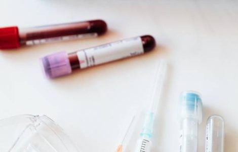 test tube blood sample/ Serum Iron Test